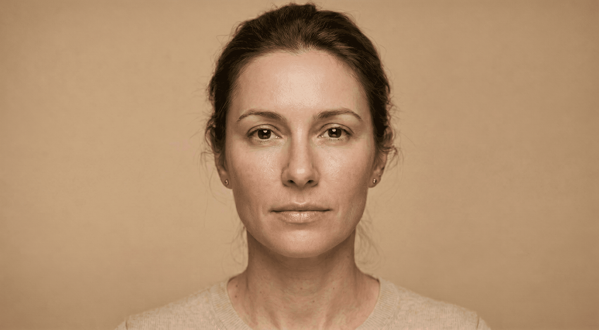 Microneedling